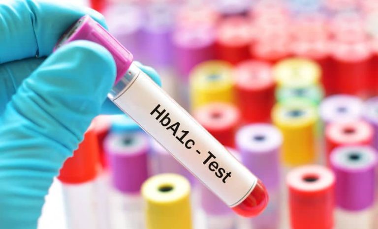 A1C Test Meaning, Normal Range, and Practical Steps