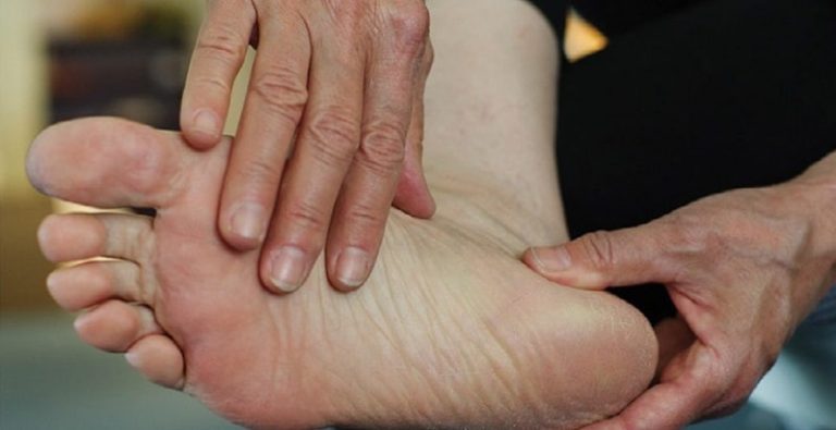 Diabetic Blisters: Symptoms, Causes, and Safe Care