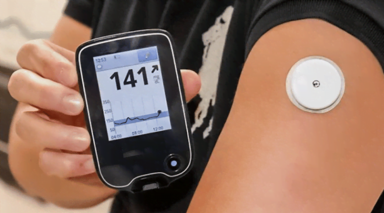 Glucose Monitor Choices: Meters, CGMs, and Safety Checks